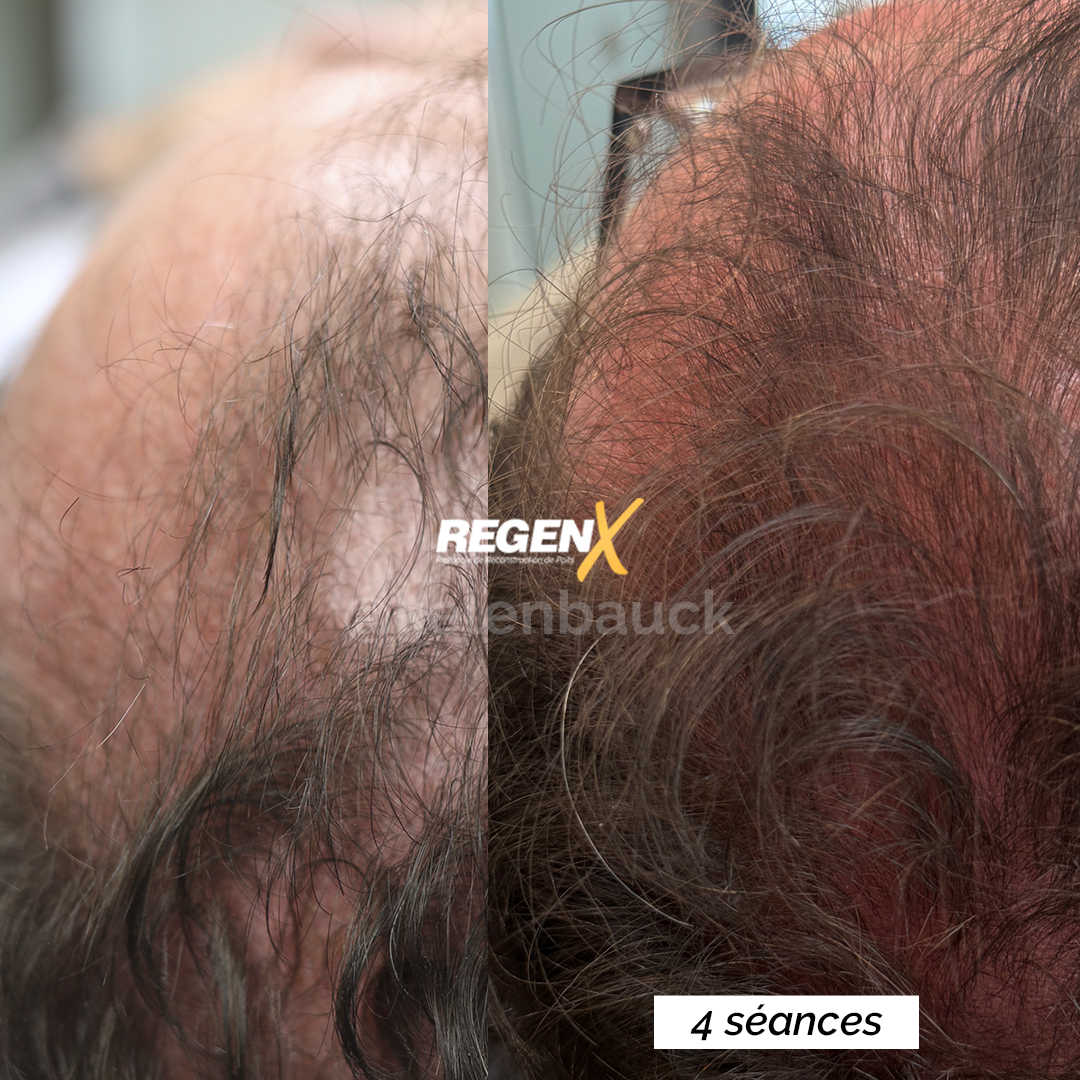 Resultado cabelo