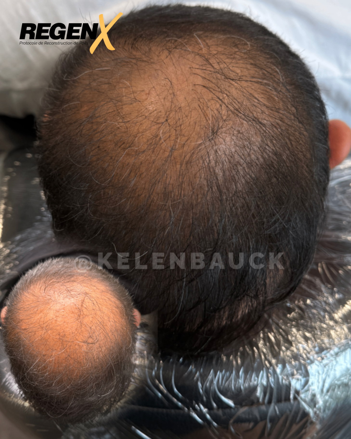 Recuperação do Cabelo